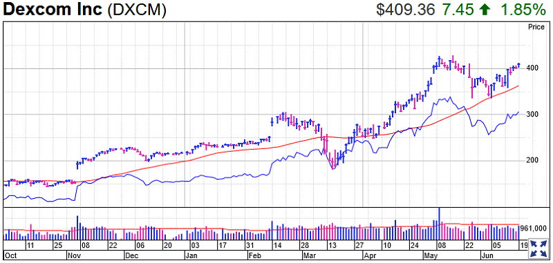 Dexcom Stock Chart